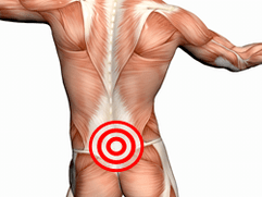 Symptoms and treatment of lumbar osteochondrosis