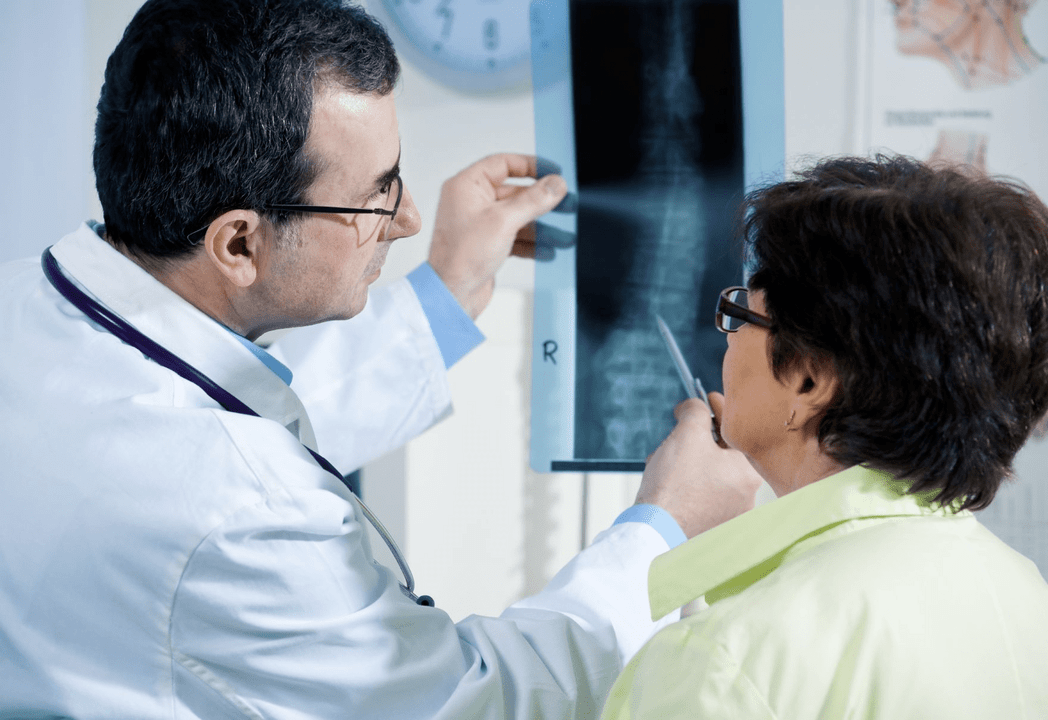A neurologist diagnoses osteochondrosis using X-ray of the spine