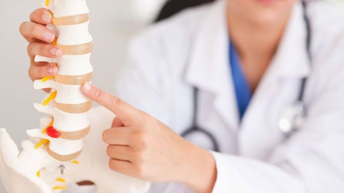 explanation of lumbar osteochondrosis in a model of the spine